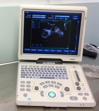 Scanner for pregnancy and birth