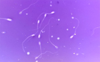 Sperm under a microscope - investigating infertility in dogs
